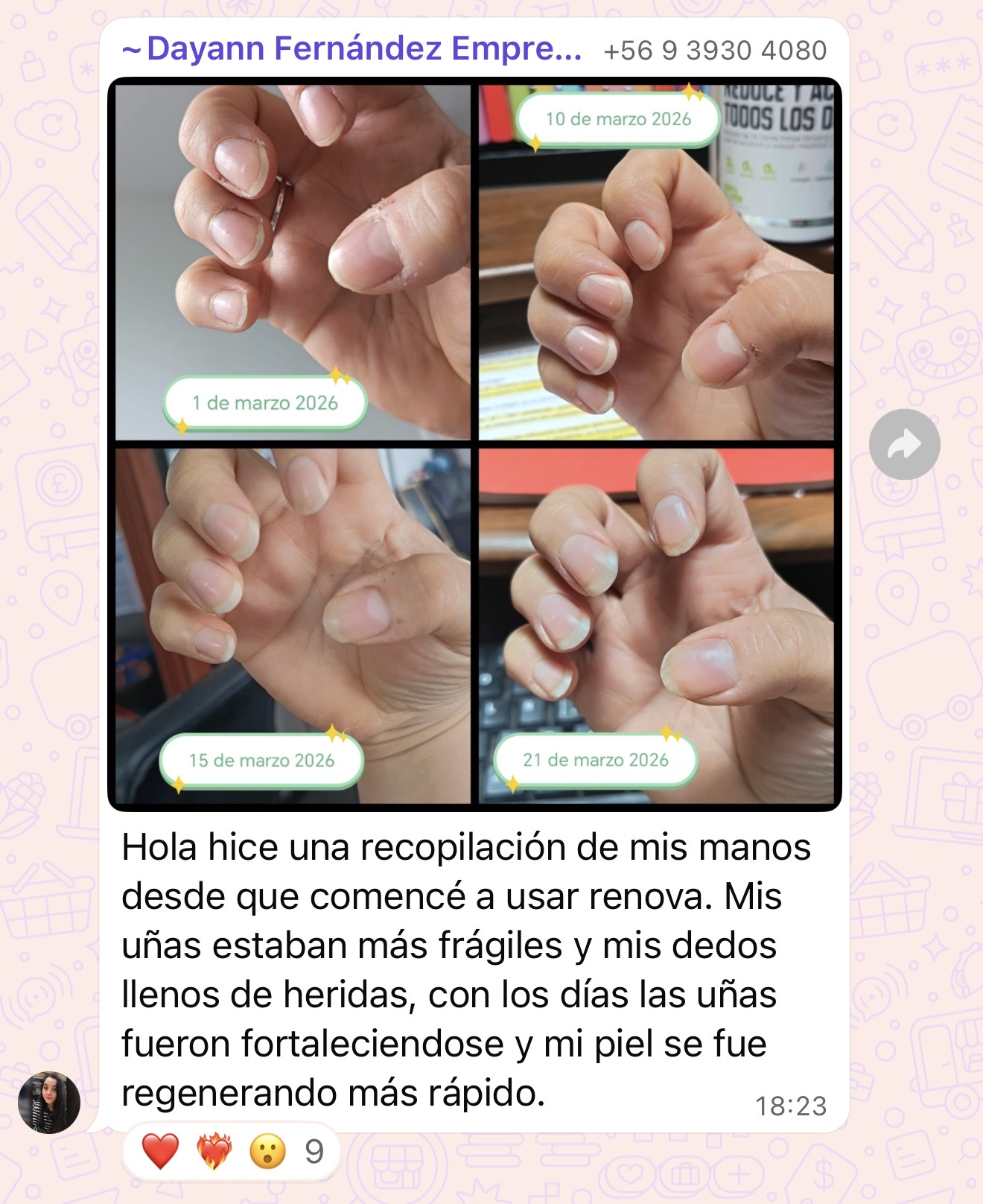 Testimonio uñas RENÖVA